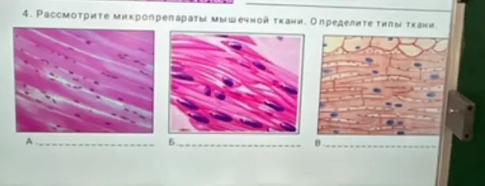 Определи типы тканей на микропрепаратах мышечной ткани