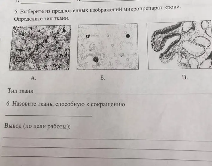 Определи тип ткани на изображениях микропрепарата крови и назови ткань, способную к сокращению