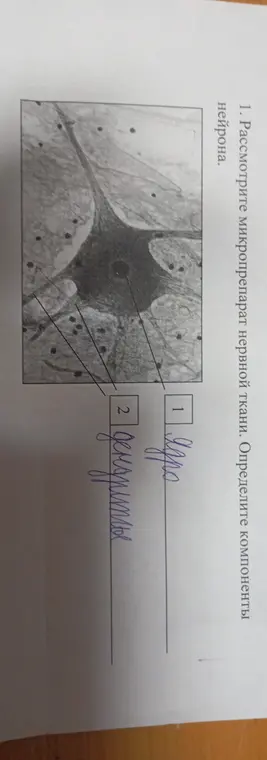 Помоги определить компоненты нейрона на микропрепарате нервной ткани