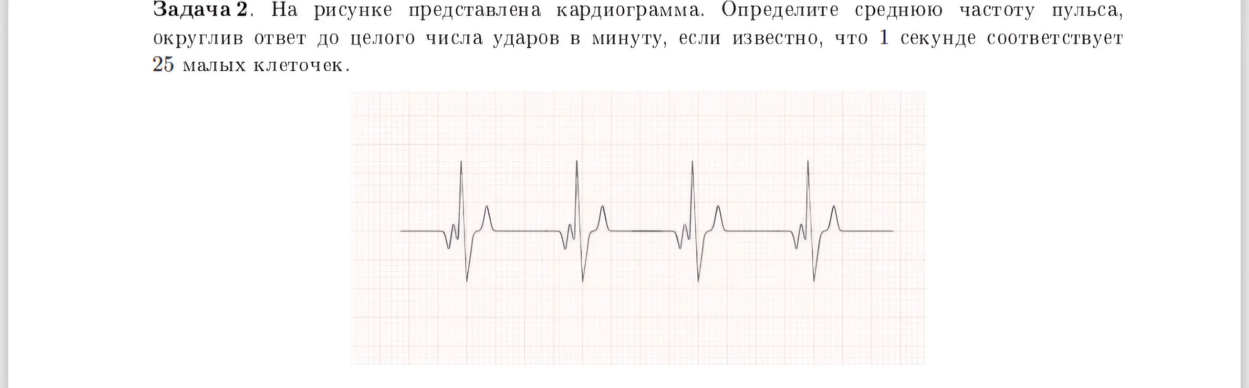 Определи среднюю частоту пульса по кардиограмме, если известно, что 1 секунде соответствует 25 малых клеточек