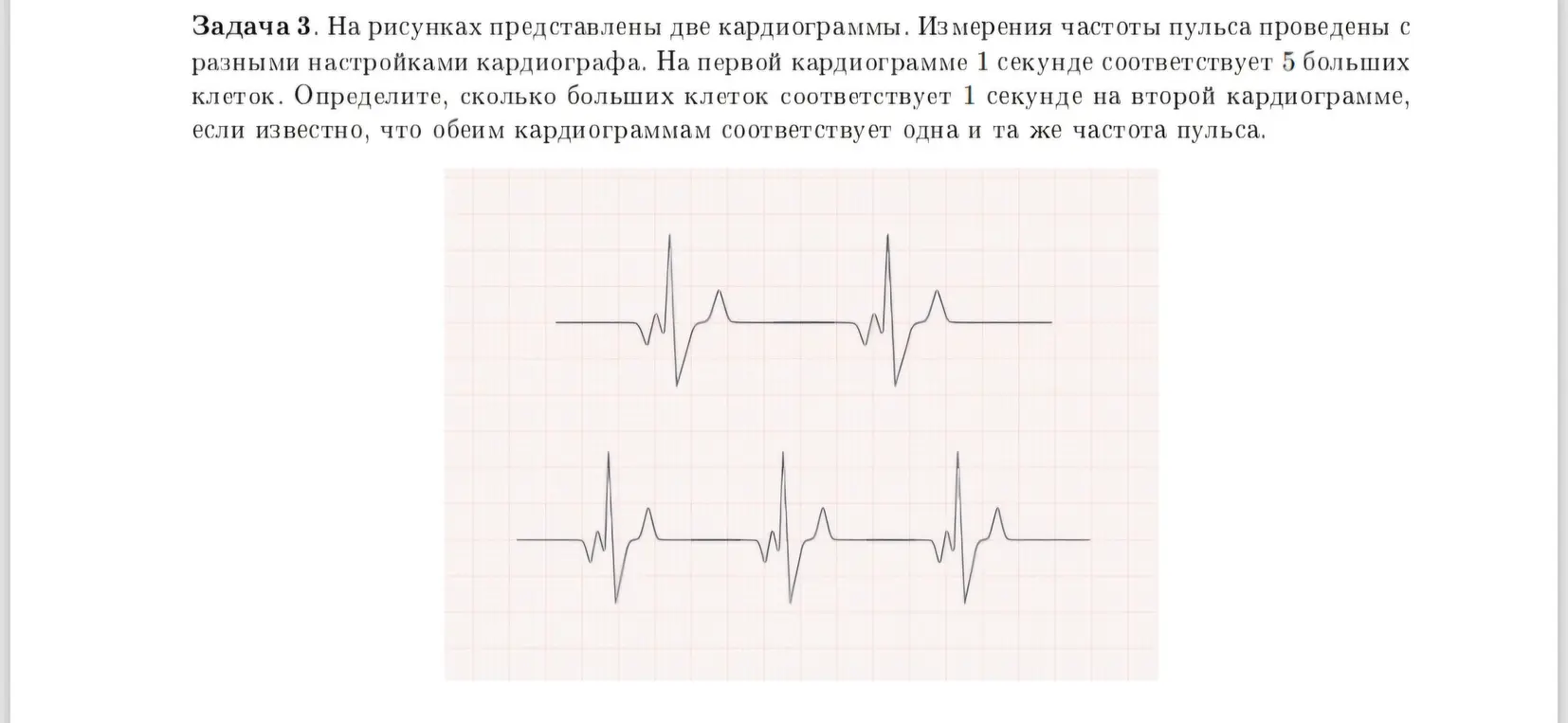 Определи, сколько больших клеток соответствует 1 секунде на второй кардиограмме, если известно, что обеим кардиограммам соответствует одна и та же частота пульса.
