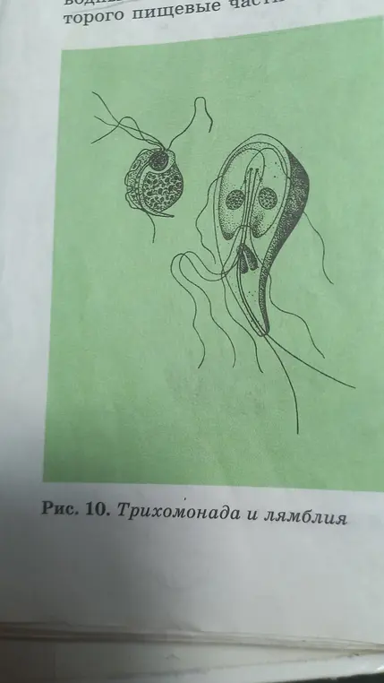Ты просишь меня подготовить сообщение про трихомонаду и лямблию по картинке.