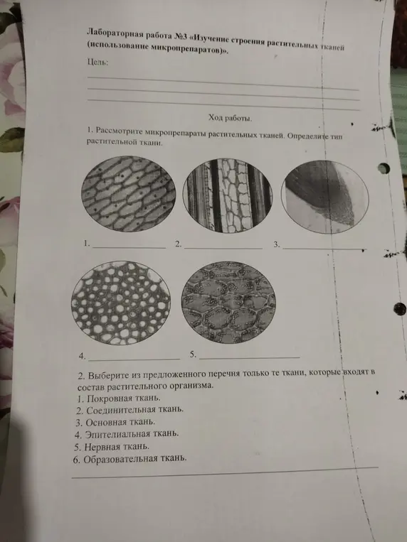 Определи тип растительной ткани на микропрепаратах и выбери ткани, входящие в состав растительного организма.