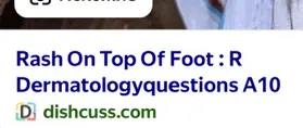 Переведи текст на изображении: "Rash On Top Of Foot : R Dermatologyquestions A10"