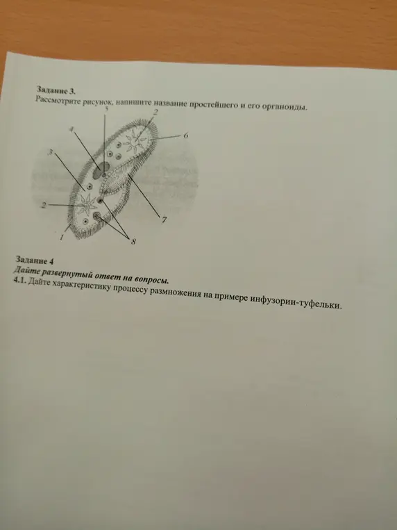 Рассмотри рисунок, напиши название простейшего и его органоиды. Дай характеристику процессу размножения на примере инфузории-туфельки.