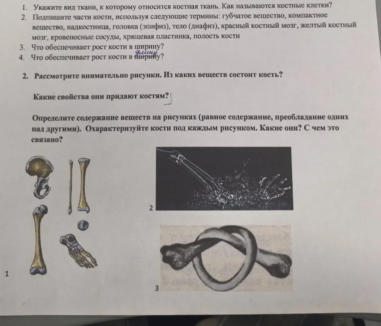 Укажи вид ткани, к которому относится костная ткань. Как называются костные клетки?