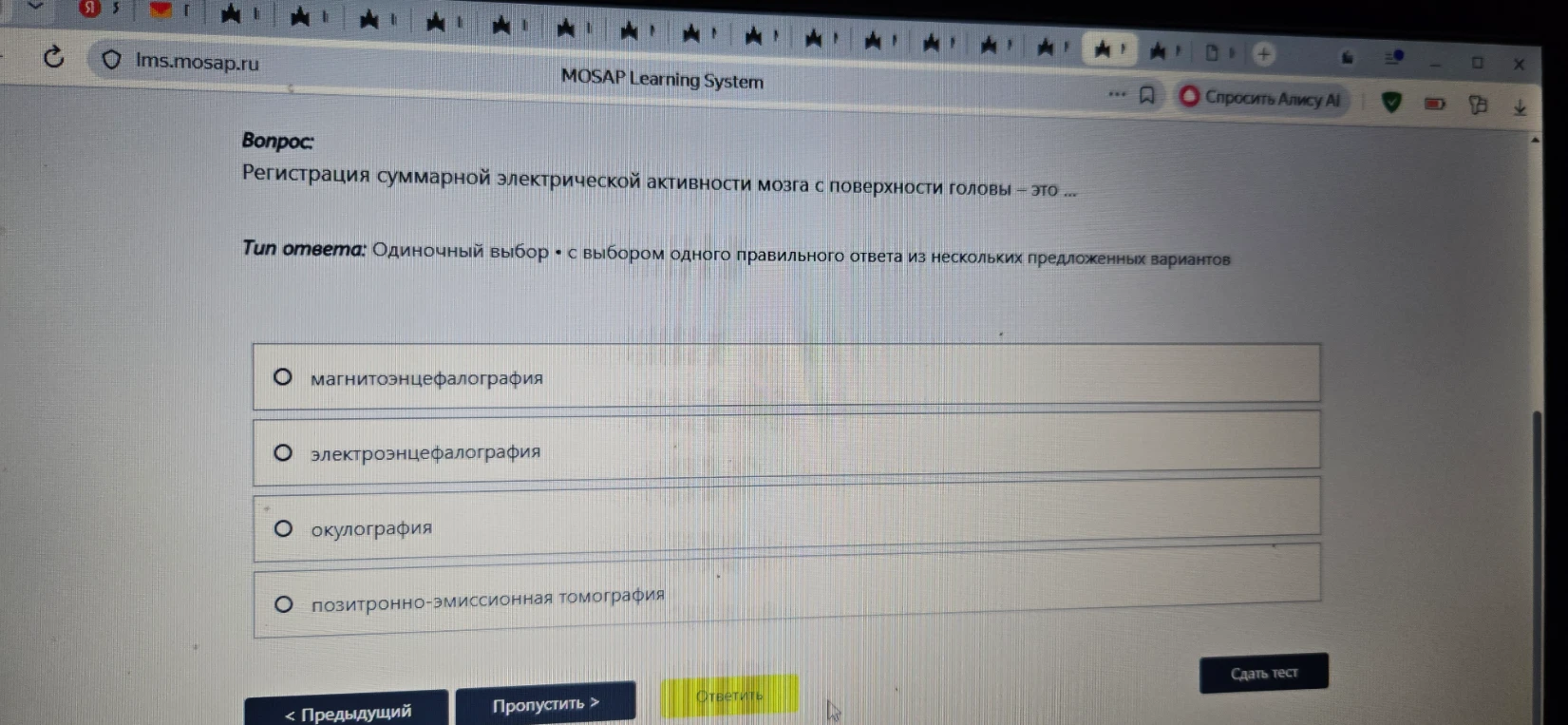 Регистрация суммарной электрической активности мозга с поверхности головы — это ...