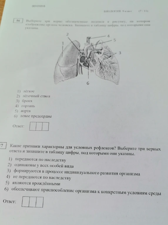 Выберите три верно обозначенные подписи к рисунку, на котором изображена органа человека. Запишите в таблицу цифры, под которыми они указаны.