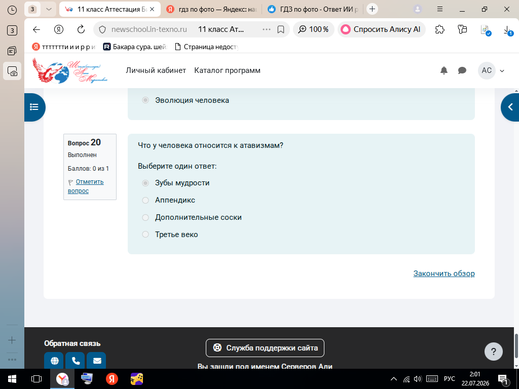 Что у человека относится к атавизмам?